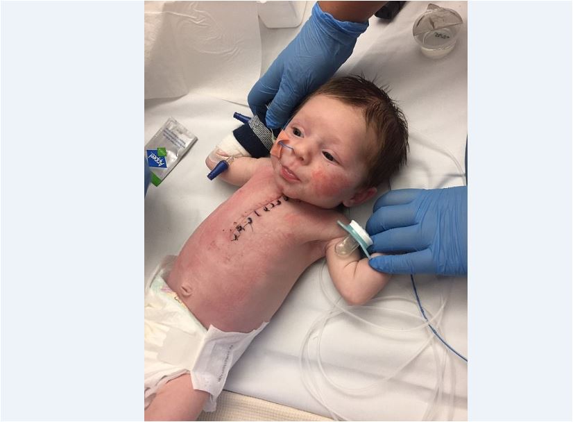 جراحات القلب المفتوح للأطفال